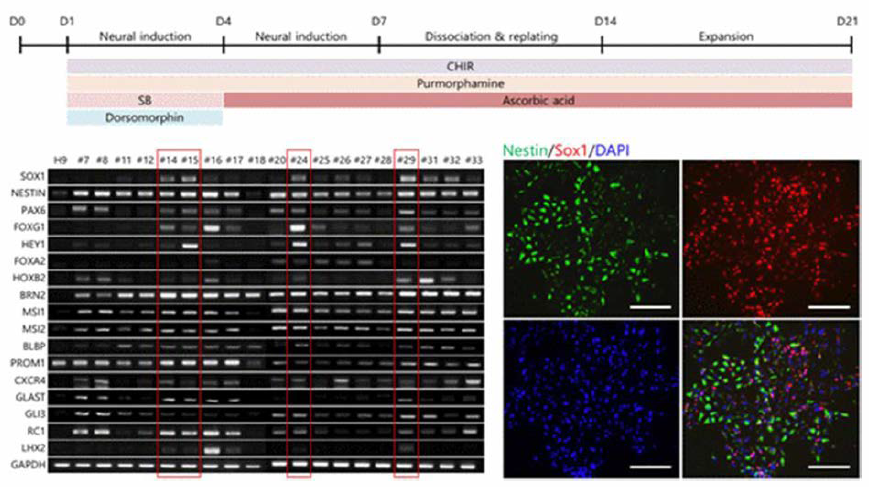 신경전구세포 분화 방법 및 생산된 신경전구세포 분석