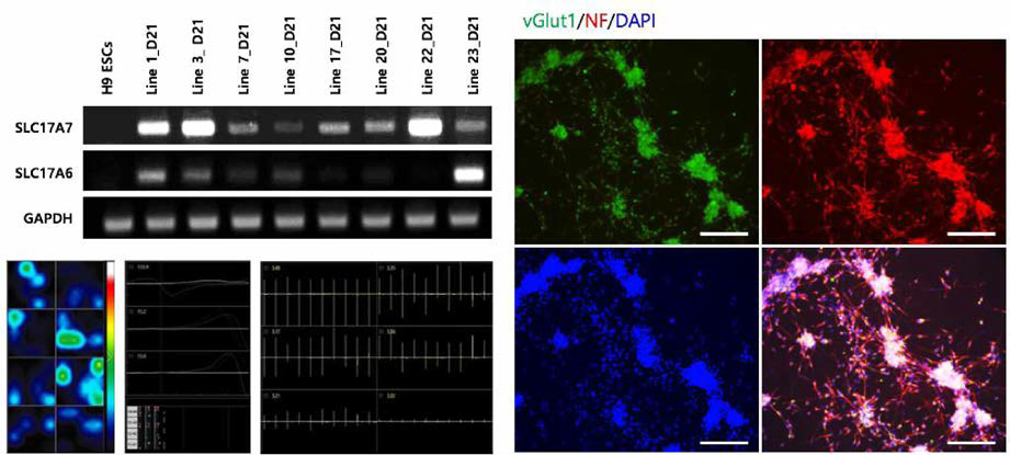글루타메타제성 신경세포 분석 및 분화 방법