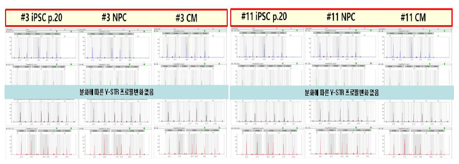 iPSC P20 및 분화이후 Y-STR profile 왼쪽부터 iPSC, NPC, CM의 Y-STR profile