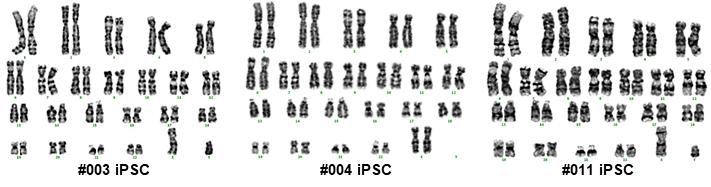 PBMC 환자유래 iPSC 핵형분석