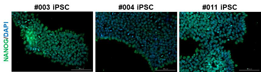 환자 유래 iPSC 줄기세포 마커분석