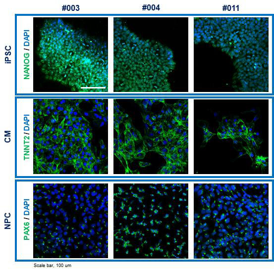 면역염색을 이용한 iPSC, 심근세포, 신경세포의 확인