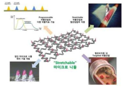 융복합 혁신 의료기기 사례/마이크로니들 기반 의료용 메쉬