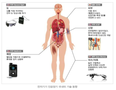 전자기기 인공장기 국내외 기술 동향