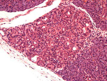 25VHF124; Inflammation, chronic