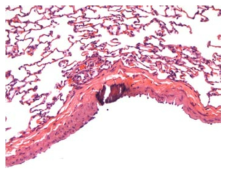 25CM002; Mineral, blood vessel