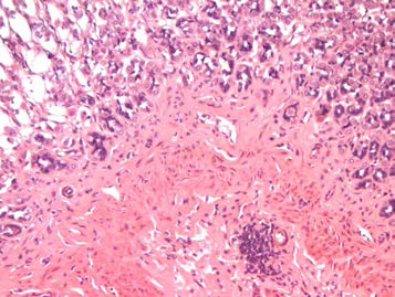 25VHM055; Amyloid