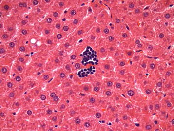 25VHM068; Extramedullary hematopoiesis, focal, minimal