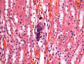 25CF081; Mineral, tubule