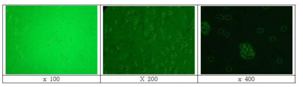 계대배양 24시간 THP-1 세포 위상차 현미경 관찰 모습