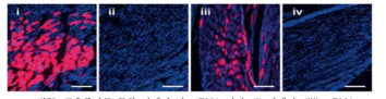 근육주사를 통한 단백질 및 mRNA 전달. (i) 단백질, (iii) mRNA (Angewandte Chemie, 2020, 132.35: 15067～15074)