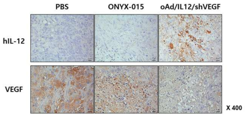 인체 폐암 이종이식 동물 모델에서의 oAd/IL12/shVEGF 투여에 따른 종양 내 IL-12 발현 확인