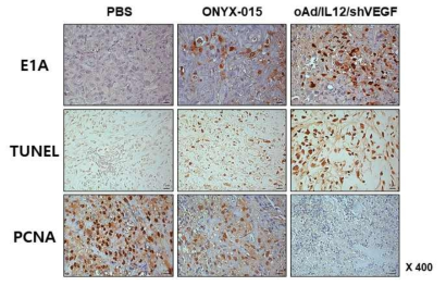 인체 폐암 이종이식 동물 모델에서의 oAd/IL12/shVEGF 투여에 따른 종양 내 변화 확인