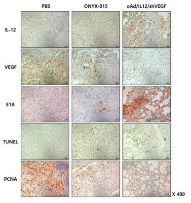 인체 폐암 동소이식 동물 모델에서의 oAd/IL12/shVEGF 투여에 따른 종양 내 변화 확인