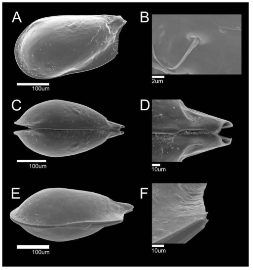 패충류 동정을 위한 주사전자현미경 사진. Pseudocythere sp. 1. A: external view, B: seta pore type, C: Dorsal view, D: Dorsal view, focused on posteriorly, E: Ventral view, F: Ventral view, focused on posteriorly