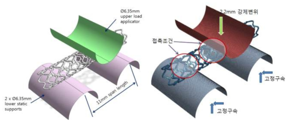 생분해성 스텐트 유연성 평가를 위한 기하형상 모델링 및 경계 조건