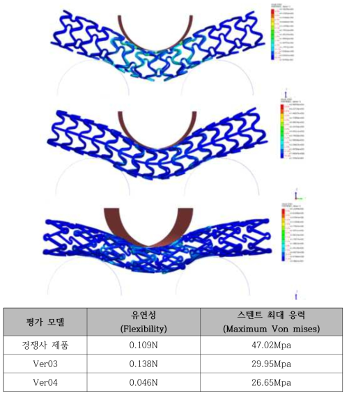 생분해성 스텐트 유연성 유한요소해석 결과