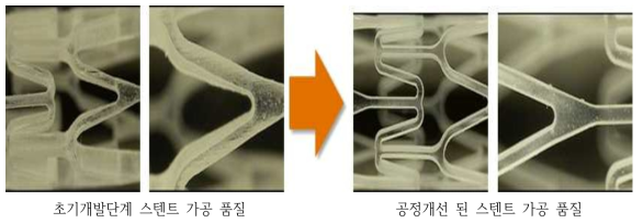 스텐트 레이저 가공 공정 확립