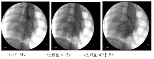 전임상동물모델 관상동맥의 혈관 조영술