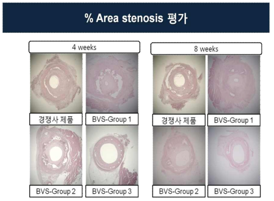 돼지 동물 실험에서 조직분석을 이용한 전임상 평가