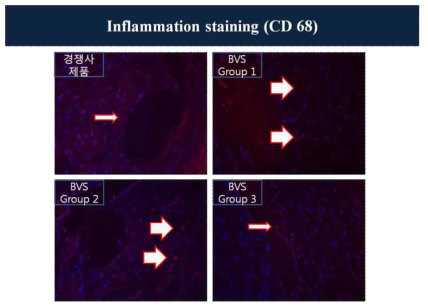 CD 68 염색을 이용한 염증 평가
