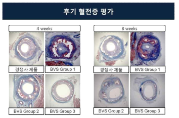 돼지 동물 모델에서 조직분석을 이용한 후기 혈전증 평가