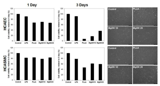 수산화마그네슘의 함량에 따른 세포 독성 및 염증 효과
