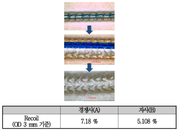 스텐트 리코일 평가