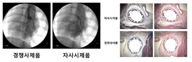 혈관 조영술 및 조직 병리학적 분석