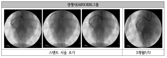 경쟁사 전임상 시험 Angiography