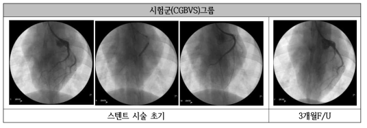 시제품 전임상 시험 Angiography