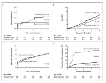 Sirolimus 방출 스텐트과 금속 스텐트의 임상시험 결과 비교
