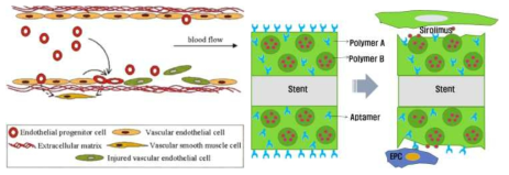 스텐트 개발의 양면의 날 측면(재협착방지, 재내피세포화)
