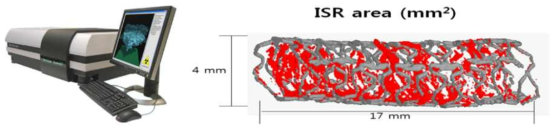 미세단층 촬영기법을 이용한 정량적 평가 및 3차원 이미지 구현