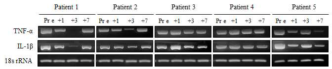 제대혈 세포 치료 후 각 환자에서의 TNF-α, IL-1β의 변화 (RT-PCR)