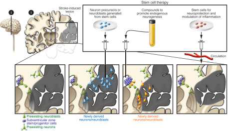 줄기세포를 활용한 뇌졸중 치료 (J Clin Invest, 120(1), 2010)