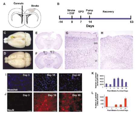 국소 뇌졸중에서 EGF+EPO 치료 시(A, B), 손상된 뇌조직이 회복됨(D). 처치를 하지 않은 뇌졸중에는 병변내 동공(cavity)이 형성됨(C). EGF에 의해 뇌실하 영역의 신경전구세포가 증식하고 병변 부위로 이동하며, 이들이 EPO에 의해 분화된 것으로 보임 (J Cereb Blood FlowMetab, 27(5), 2007)