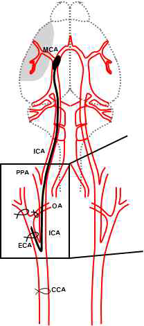 Middle Cerebral Artery Occlusion (MCAO) 모델유발 모식도.CCA: common carotid artery, ECA: external carotidartery, ICA: internal carotid artery