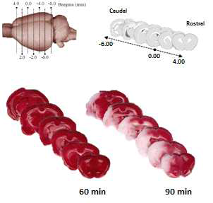 MCAO model에서 혈관 폐색 시간에 따른infarct volume 확인