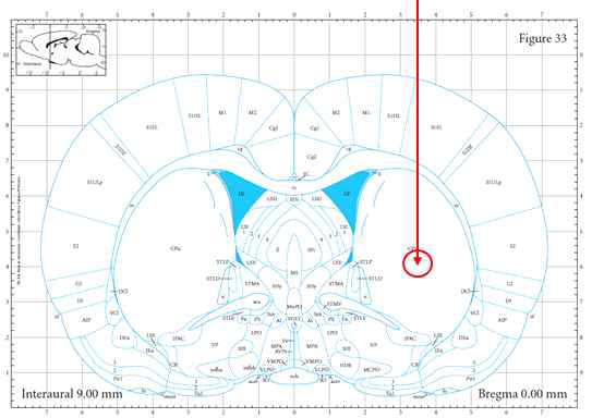 ICH 모델의 Bacterial Collagenase 주입 위치 (George Paxinos & Charles Watson – THE RAT BRAIN)