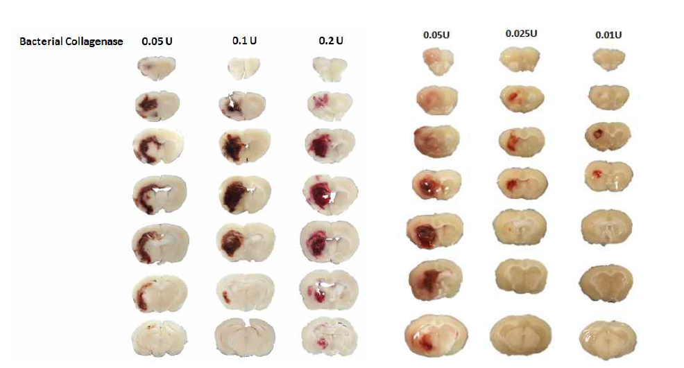 농도별 Bacterial collagenase 주입 3일 후 hemorrhage 확인