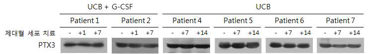 뇌졸중 환자의 혈장을 이용한 제대혈 세포 치료 후 PTX3의 변화