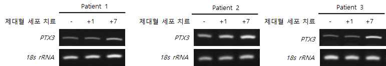 RT-PCR 결과 : 제대혈 치료 후 PTX3의 발현양. (n=3)