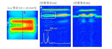 결함 패키지 칩의 단층영상 분석 예: 200 μm간격의 이중 반사층을 보임