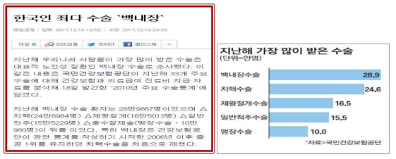 한국인이 가장 많이 받은 수술 ‘백내장수술’