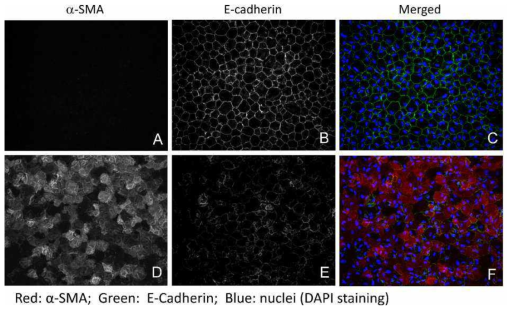 alpha-SMA과 E-cadherin에 대한 면역화학적염색을 실시하여 수정체상피세포의 상피-간엽 전환(epithelial-mesenchymal transition)을 확인함
