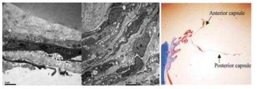 가토에서 분리한 수정체낭의 면역학적 염색 및 전자현미경 (TEM) 사진