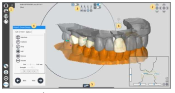 CAD S/W(RAYDENT Designer)