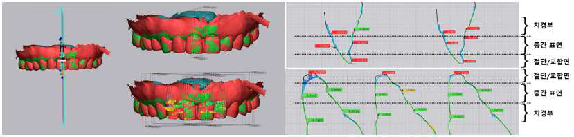 Intraoral/CBCT obejct scan 데이터 비교를 위한 비교평면