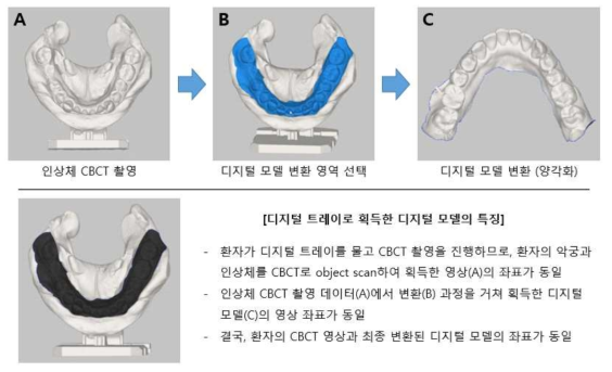 디지털 트레이로 획득한 디지털 모델의 특징